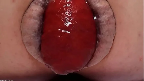 Contender For Biggest Prolapse (Male Warning!)