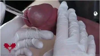 Perfect Extraction Of Sperm Directly From The Urethra. Close-up Of The Glass Straw Sounding