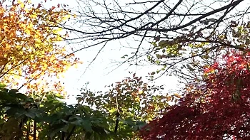 001-youth-with-areare-apd