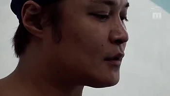 843-youth-with-areare-idv