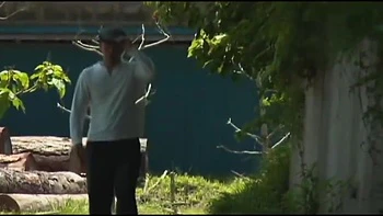 007-youth-with-areare-tds